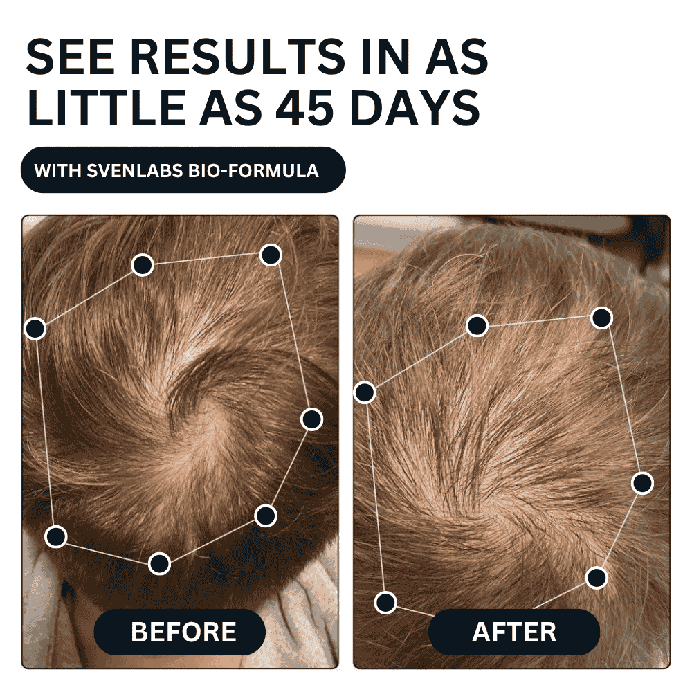 Unlock Thicker, Stronger Hair—One Shot a Day