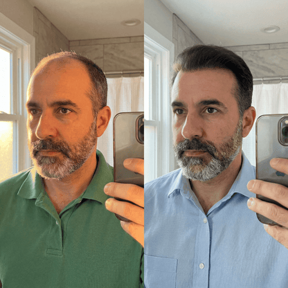 SvenLabs™ Hair Regrowth Protocol