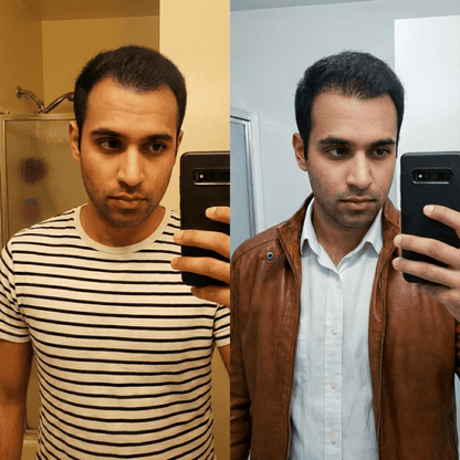 SvenLabs™ Hair Regrowth Protocol