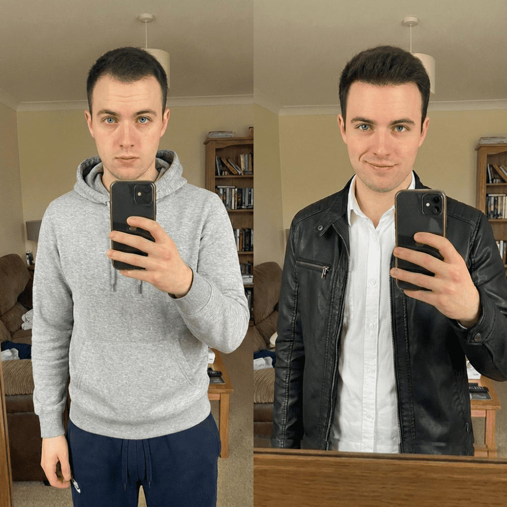 SvenLabs™ Hair Regrowth Protocol