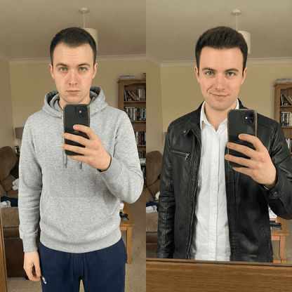 SvenLabs™ Hair Regrowth Protocol