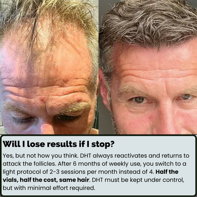 SvenLabs™ Hair Regrowth Protocol