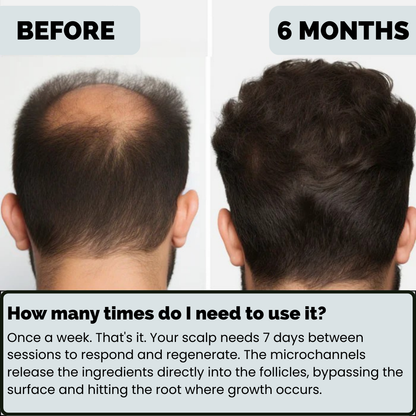 SvenLabs™ Hair Regrowth Protocol