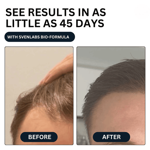 Unlock Thicker, Stronger Hair—One Shot a Day