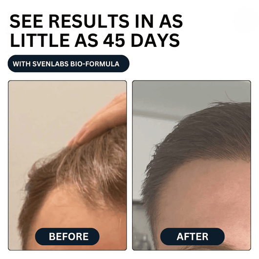 Unlock Thicker, Stronger Hair—One Shot a Day