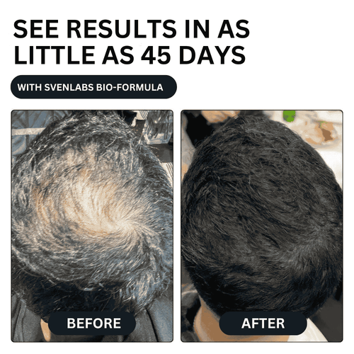 Unlock Thicker, Stronger Hair—One Shot a Day