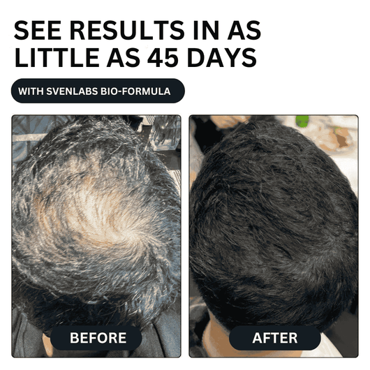 Unlock Thicker, Stronger Hair—One Shot a Day