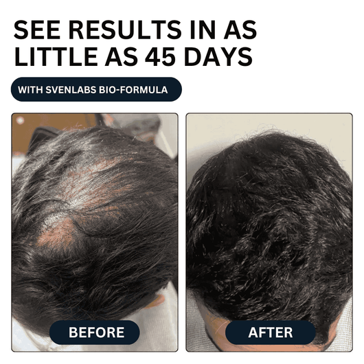 Unlock Thicker, Stronger Hair—One Shot a Day