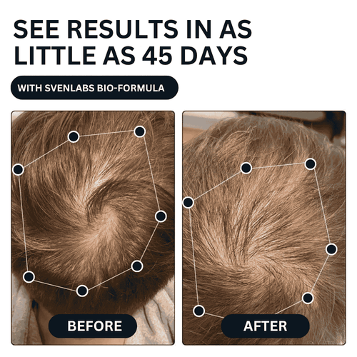 Unlock Thicker, Stronger Hair—One Shot a Day